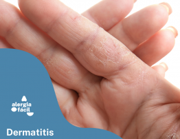 Dermatitis de manos